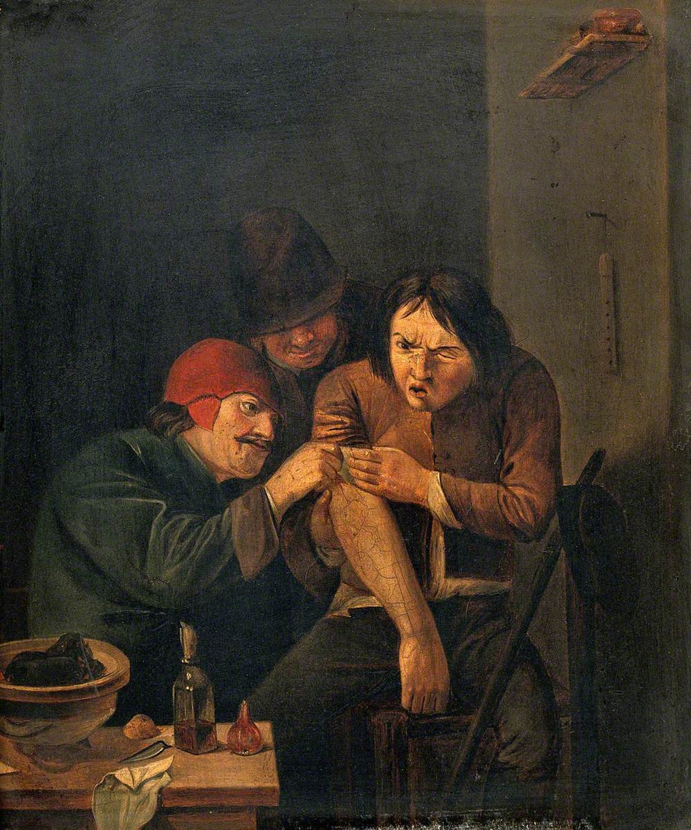 Un chirurgien soigne le bras d'un homme - Adriaen Brouwer