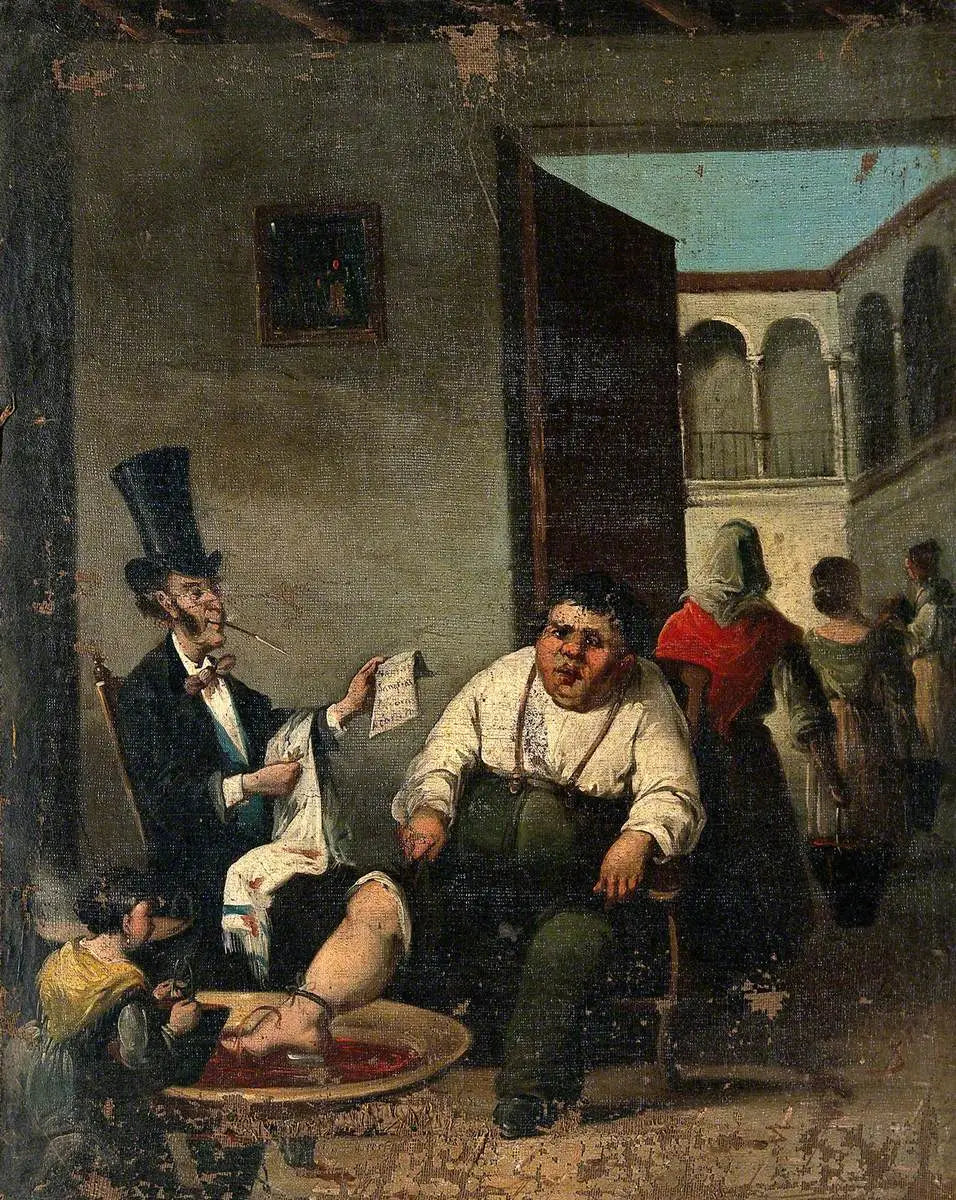 Saignée du pied - Honoré Daumier - Alpha Reproduction